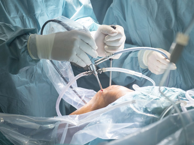 Orthopedic Surgery in Lucknow